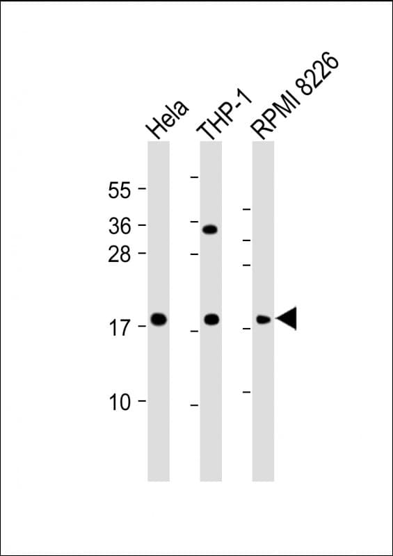 GPX7 Antibody (Internal)