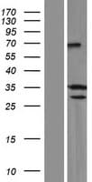 SYCE1 Protein (Over-Expression Lysate Myc-DDK (Flag))