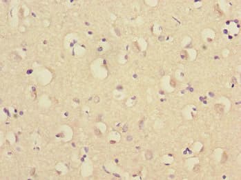 TRIM69 / Trif Antibody