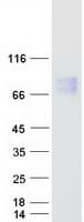 Human CBFA2T2 / MTGR1 Protein (Recombinant Myc-DDK (Flag))