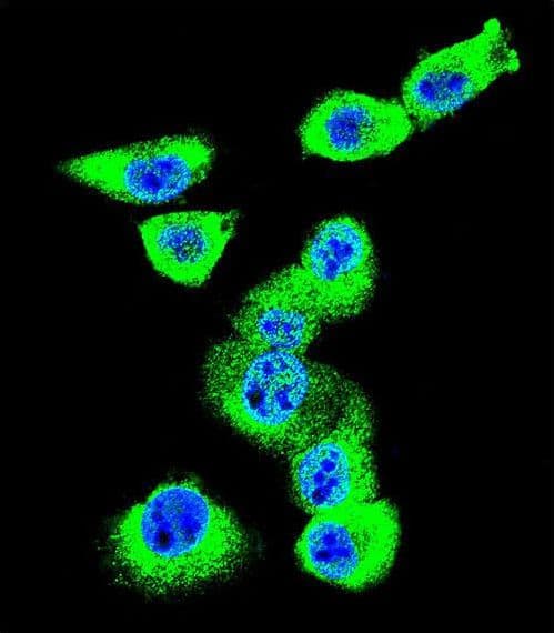 Polyclonal Rabbit anti-Human CAV2 / Caveolin 2 Antibody (aa11-44, IHC, IF, WB)