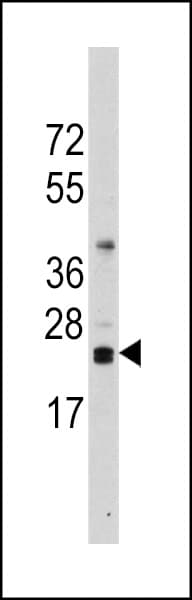 CD247 / CD3 Zeta Antibody (aa2-31)