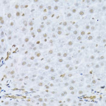 Polyclonal Rabbit anti-Human MAPK3 / ERK1 Antibody (IHC, IF, WB)