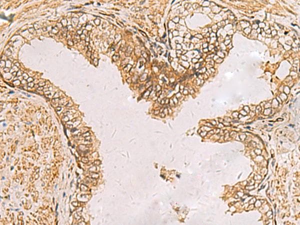 Polyclonal Rabbit anti-Human RAB38 Antibody (IHC, WB)