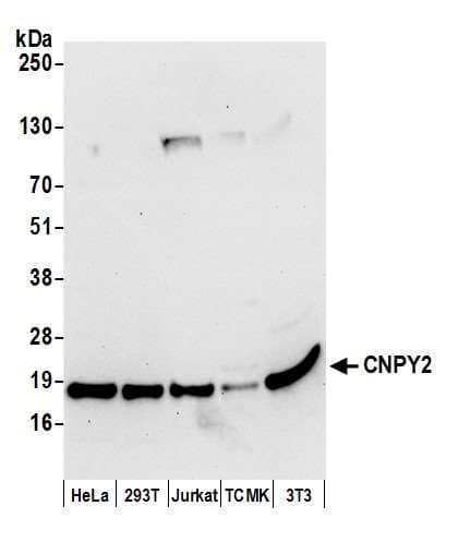 Cnpy2 / TMEM4 Antibody (aa1-50)
