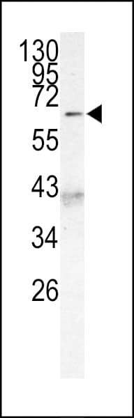 MLLT3 / AF9 Antibody (aa471-502)