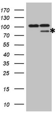MMP2 Antibody (aa228-507, clone OTI4B11)