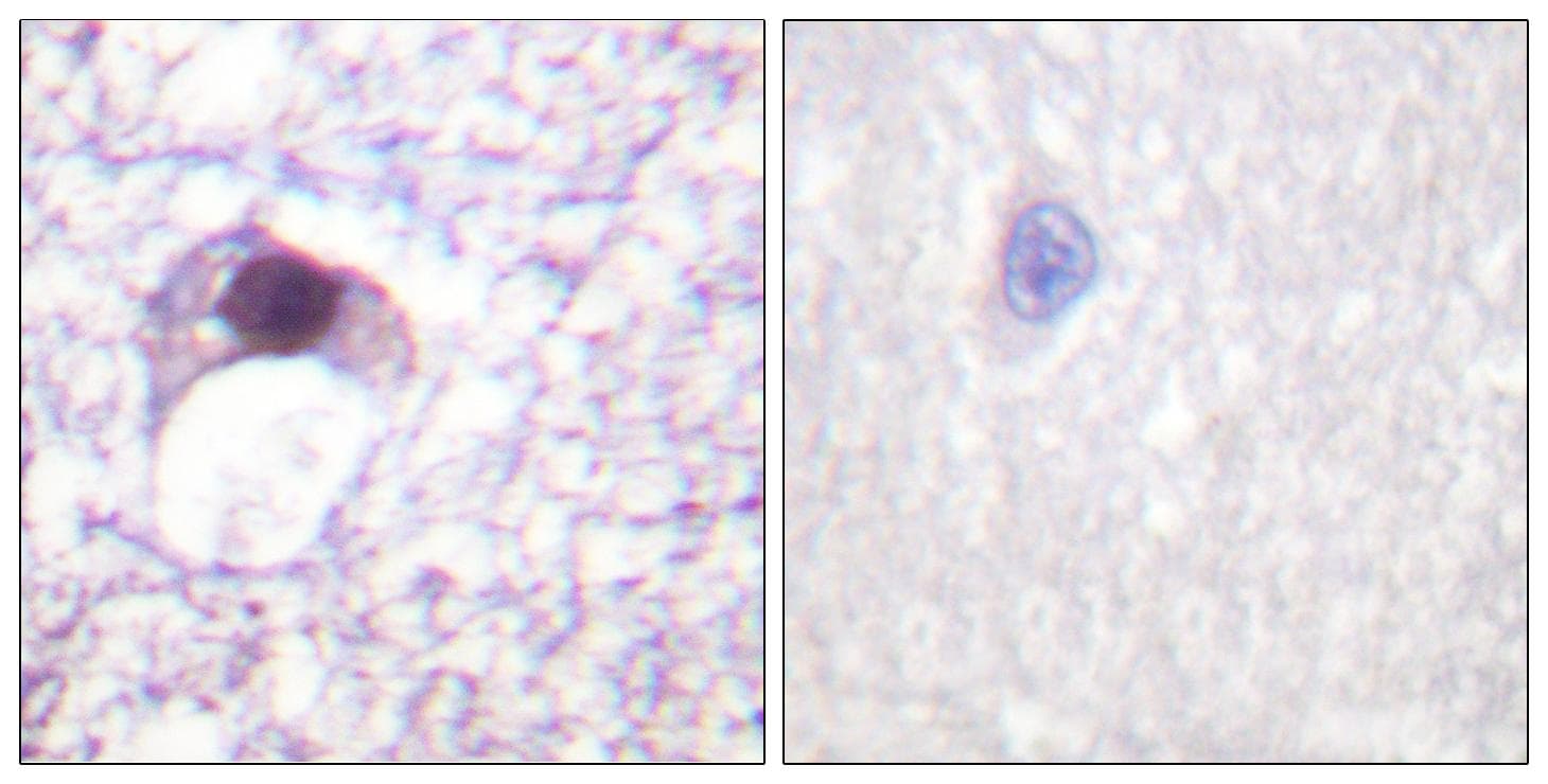 E2F6 Antibody