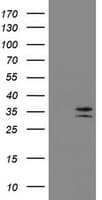 IHC-plus™ CD20 Antibody (clone 4B4)