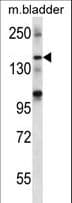 Polyclonal Rabbit anti-Human SHANK2 / SHANK Antibody (aa879-908, WB)