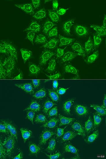 UBE2A Antibody