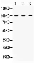 ADAM2 / Fertilin Beta Antibody