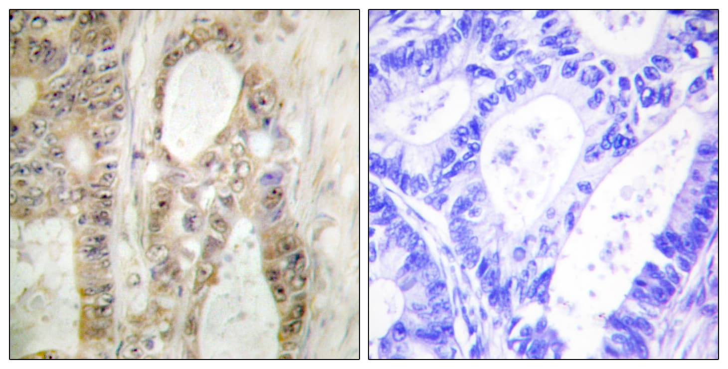 CHEK1 / CHK1 Antibody (aa266-315)