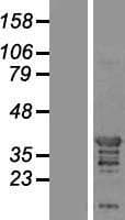 SH3GL2 Protein (Over-Expression Lysate Myc-DDK (Flag))