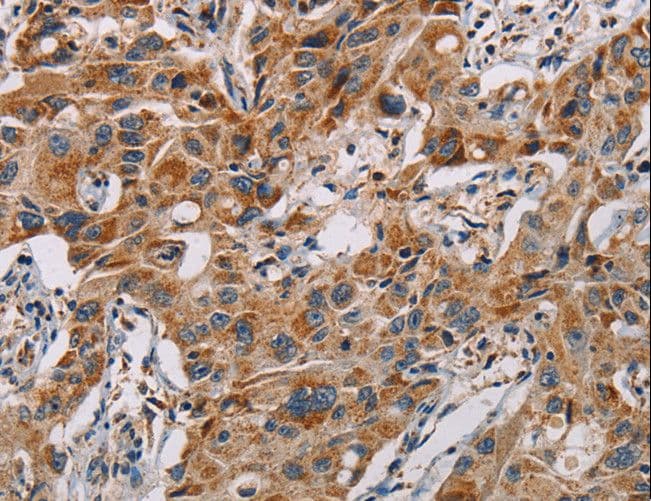 MMP1 Antibody