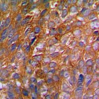 Polyclonal Rabbit anti-Human c-CBL Antibody (phospho-Tyr774, IHC, IF, WB)