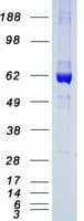 Human CES2 / Esterase Protein (Recombinant Myc-DDK (Flag))