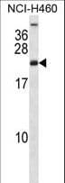RPS16 / Ribosomal Protein S16 Antibody (aa45-74)