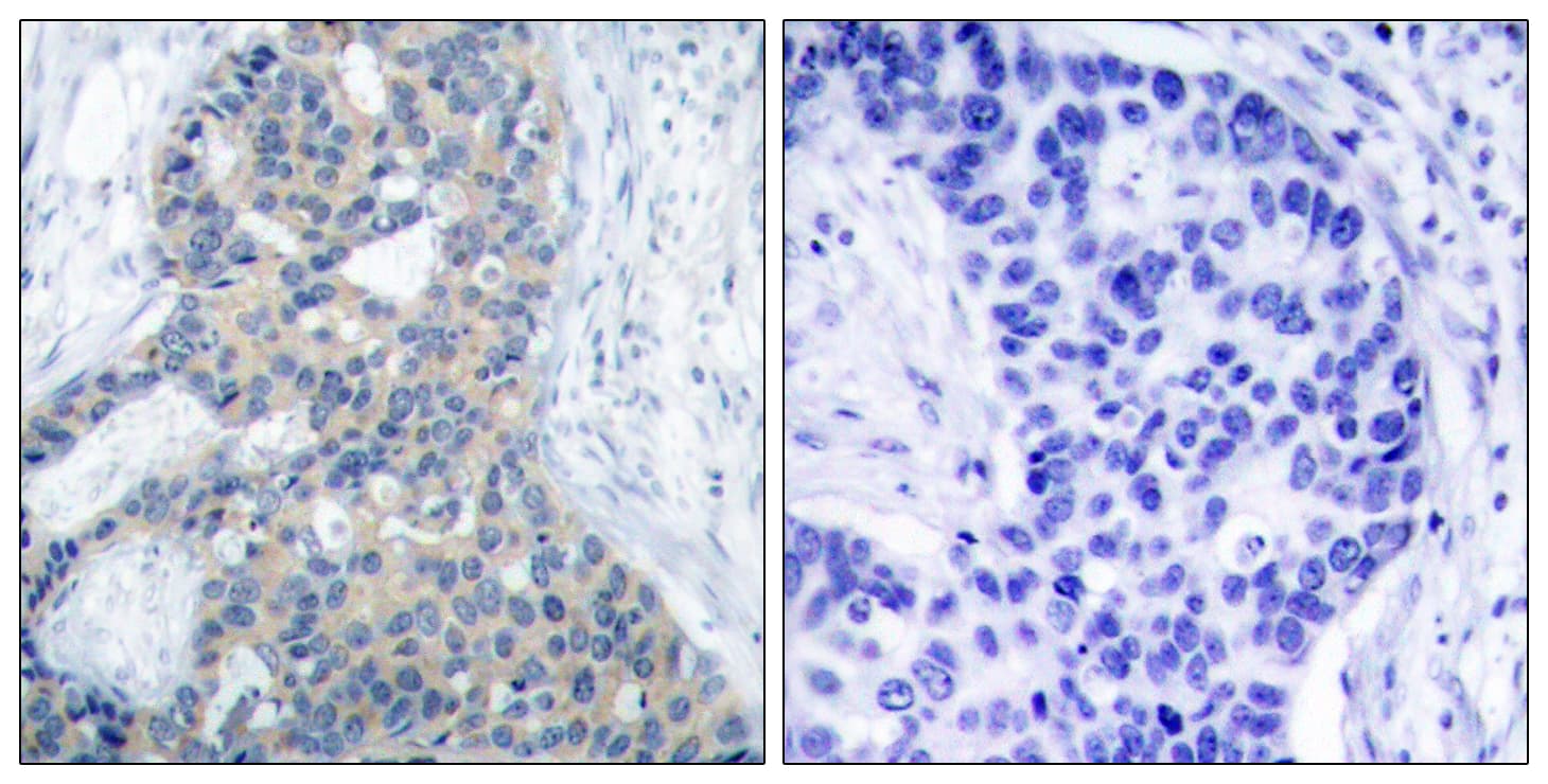 STMN1 / Stathmin / LAG Antibody (phospho-Ser37)