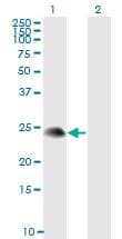 IHC-plus™ Monoclonal Mouse anti-Human TSC22D3 / GILZ Antibody (clone 3A5, IHC, IF, WB)