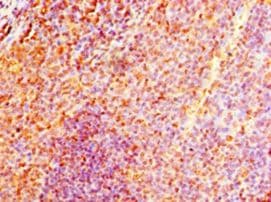 NMNAT3 Antibody (aa1-215)