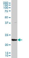 IHC-plus™ Monoclonal Mouse anti-Human GSTA3 Antibody (clone 1F11, IHC, WB)