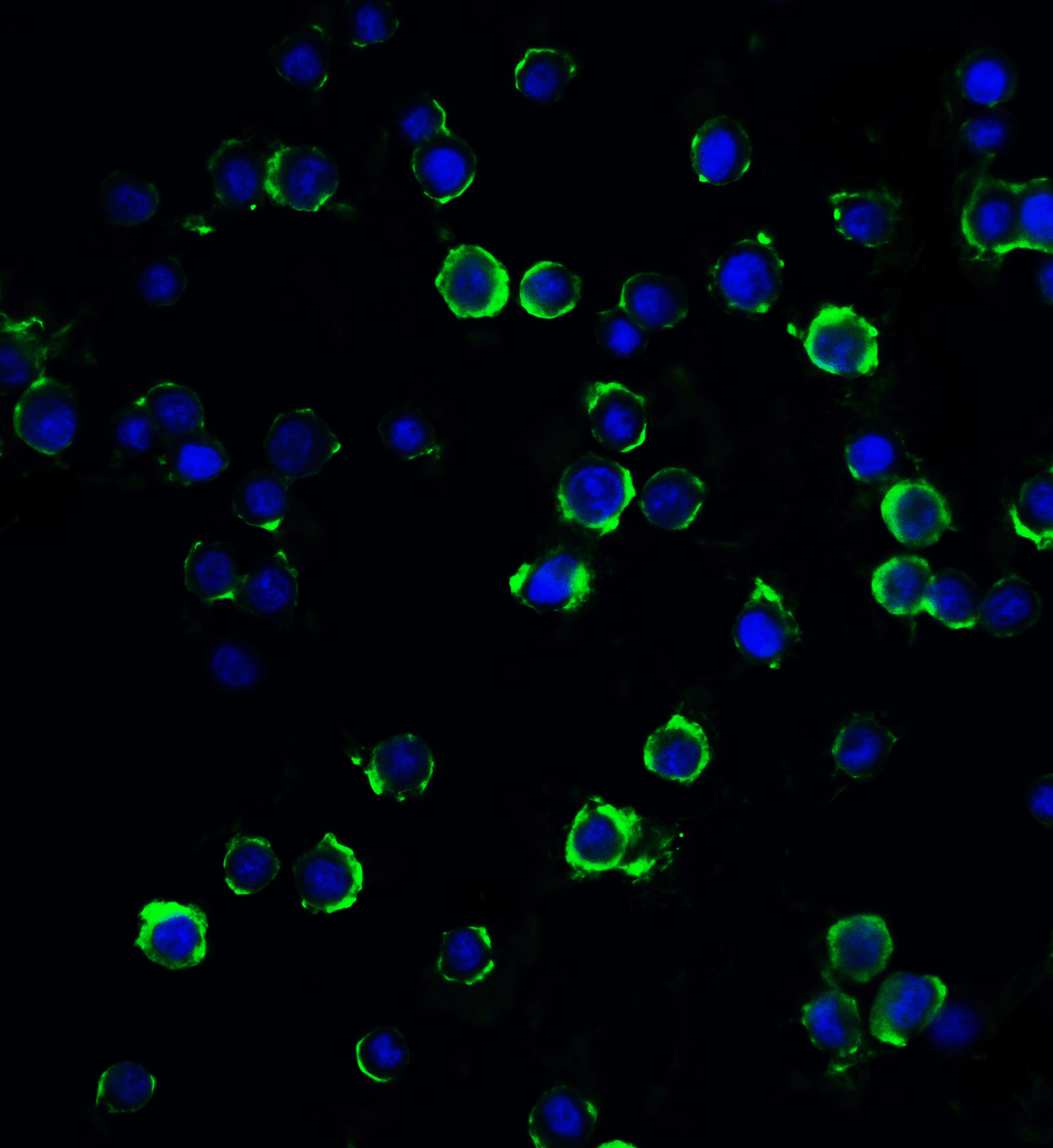 IHC-plus™ Polyclonal Rabbit anti-Human RFX / RFX1 Antibody (IHC, IF, WB)
