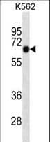 SOX9 Antibody (aa41-70)