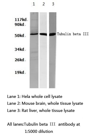 TUBB3 / Tubulin Beta 3 Antibody