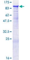Human PROS1 / Protein S (Recombinant GST)
