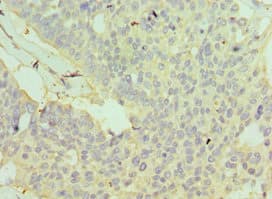 GSTO2 Antibody (aa124-243)