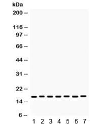 Polyclonal Rabbit anti-Human LYZ / Lysozyme Antibody (IHC, WB)