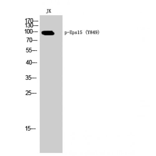 EPS15 Antibody (790-870 aa)