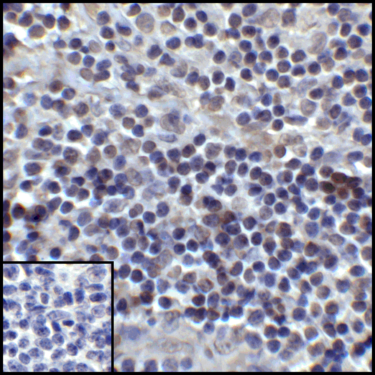 CD274 / B7-H1 / PD-L1 Antibody (clone 6H10)