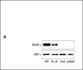 Polyclonal Rabbit anti-Human MUSK Antibody (aa35-65, IHC, WB)