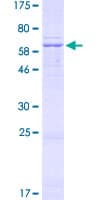 Human NDUFA9 Protein (Recombinant GST)