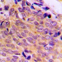 BAX Antibody (Internal)