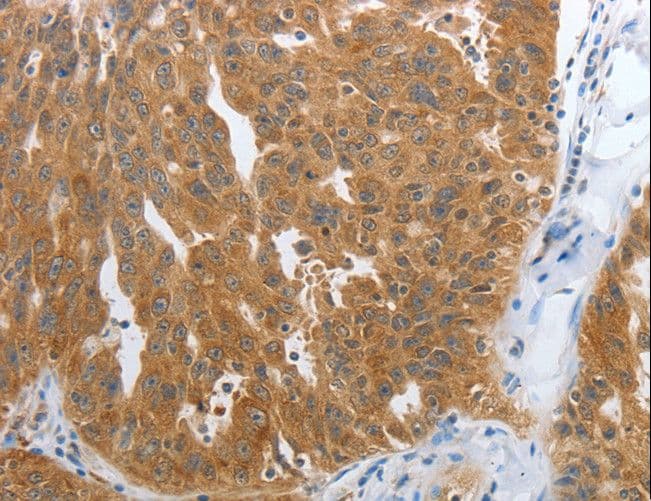 NPY1R Antibody