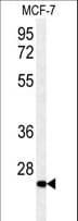 DHRS2 / HEP27 Antibody (aa197-225)