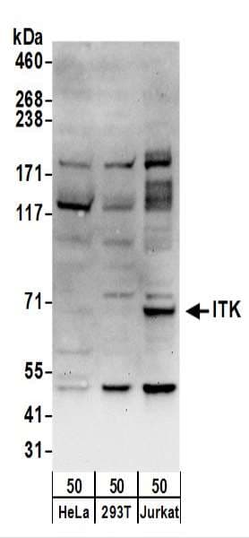 ITK / EMT Antibody (aa1-50)