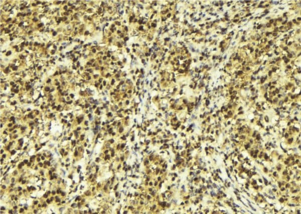 CHD9 Antibody