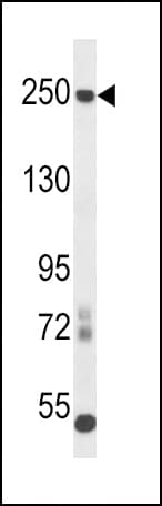 IHC-plus™ L1CAM Antibody (aa1154-1182)