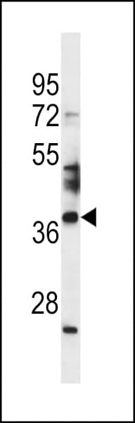 Polyclonal Rabbit anti-Human SPATA4 Antibody (aa100-129, WB)