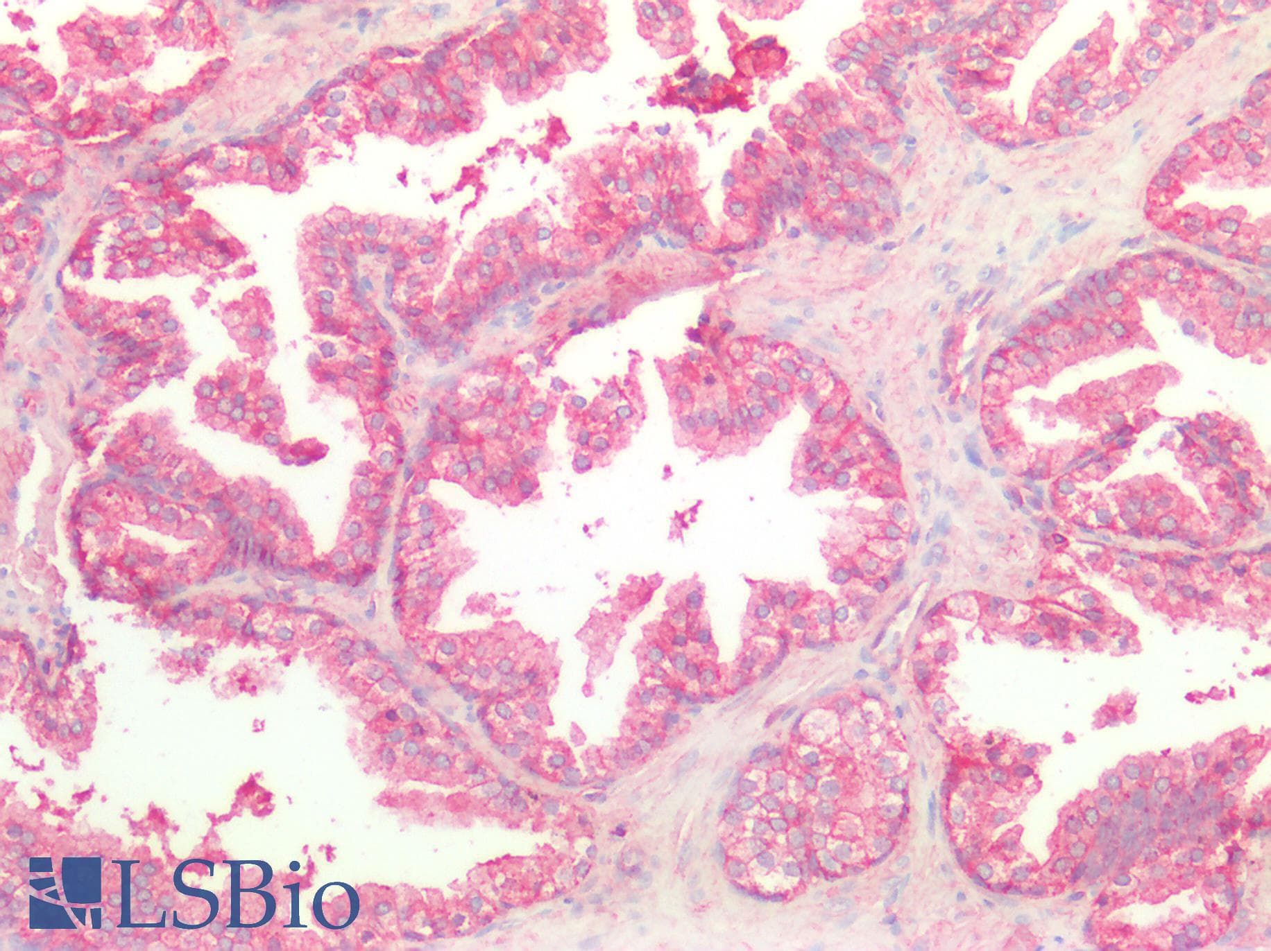 PathPlus™ Polyclonal Rabbit anti-Human CDH1 / E Cadherin Antibody (IHC)