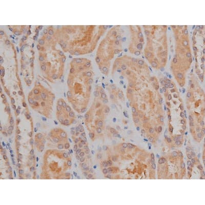 Polyclonal Rabbit anti-Human SP1 Antibody (phospho-Thr739, IHC, IF, WB)