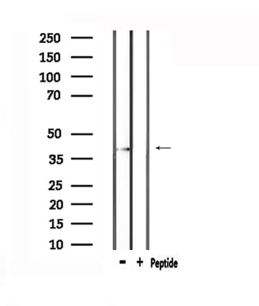 CCKAR / CCK1R Antibody