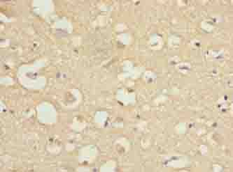 Polyclonal Rabbit anti-Human COPZ1 Antibody (IHC, WB)