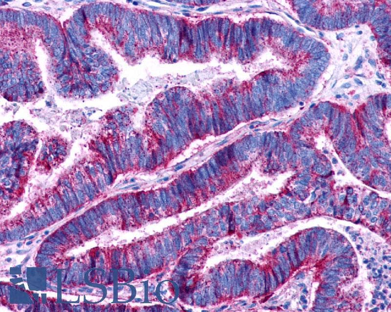 PathPlus™ Polyclonal Rabbit anti-Human LPAR3 / LPA3 / EDG7 Antibody (Cytoplasmic Domain, IHC)