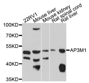 AP3M1 Antibody