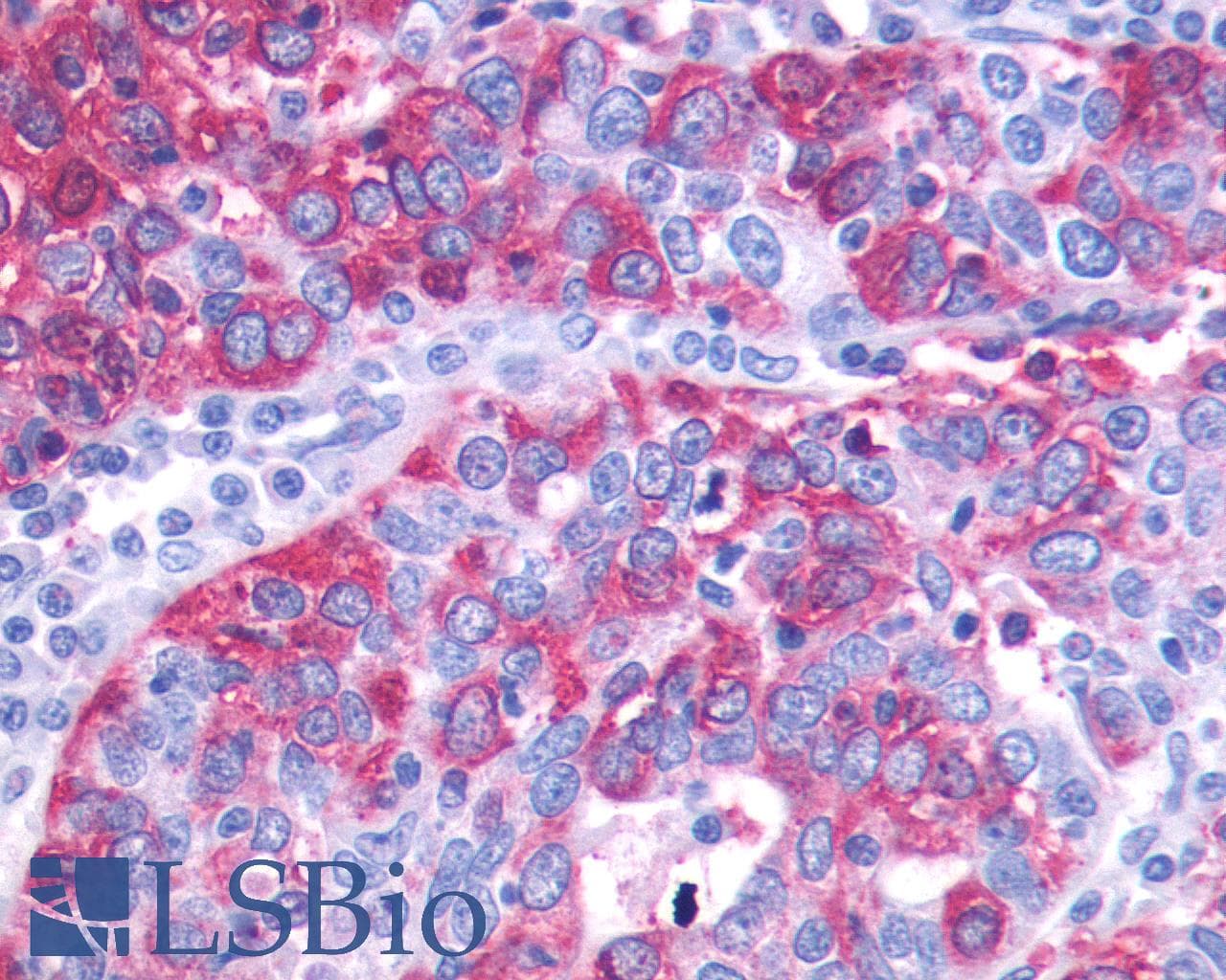 PathPlus™ GPR143 Antibody (C-Terminus)